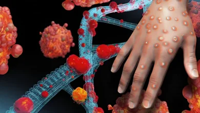 Akwa Ibom Traces Six Mpox Disease to One Household